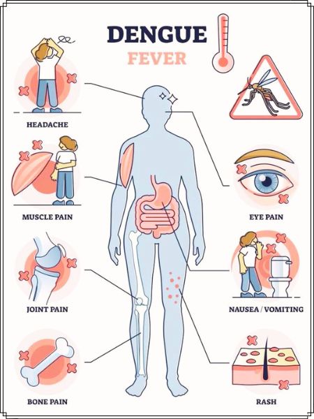 dengue-fever-symptoms-causes-and-treatment